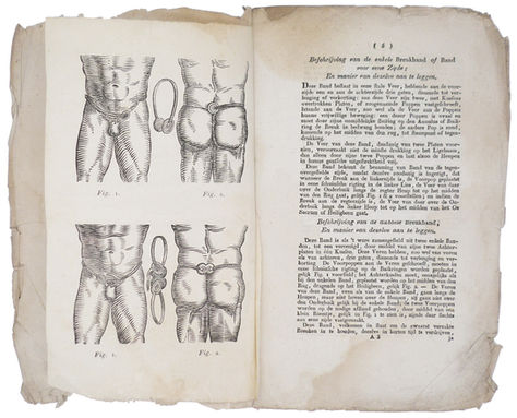 Prospectus, of Beschrijving van de elastieke mechanieke lies-, dij- en navel-breukbanden. [Ca. 1825].