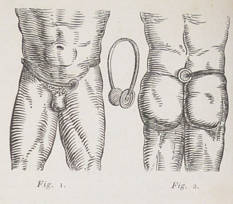 A Slow and Miserable Death: Masturbation in 1825