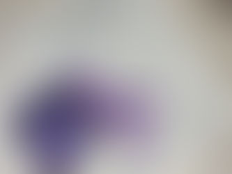 Postpartum Charting: Marquette or Billings