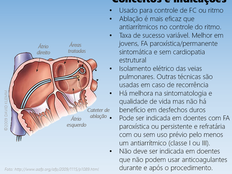 Ablação por cateter na fibrilação atrial: conceitos e indicações