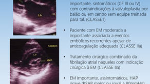 Indicações cirúrgicas na estenose mitral