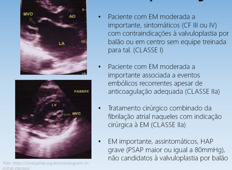Indicações cirúrgicas na estenose mitral