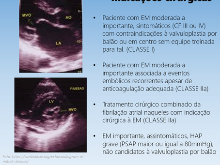 Indicações cirúrgicas na estenose mitral