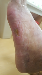 heel 3.png