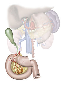 Dessin_7_whipple.jpg