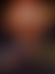 Echo Geração 2 – v1.0.38