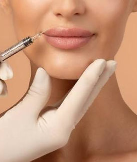 E.V_Fillers.jpeg