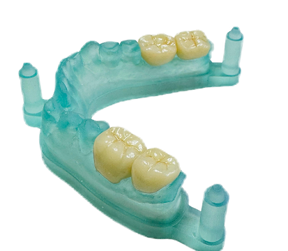 Toothrocket (3)_edited.png