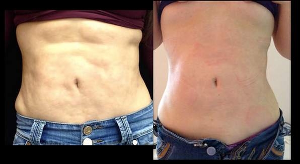 Captura de pantalla 2018-05-29 a la(s) 1