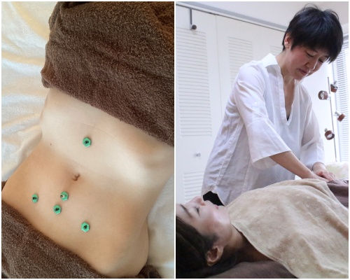 女性の体調や巡りを確認しながら全身をみて施術するkokokara鍼灸Pranaの鍼灸