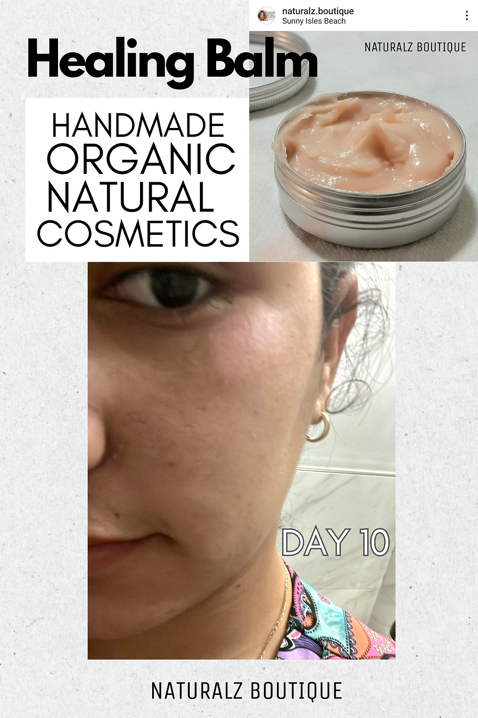 Thumbnail: Natural Essential Oil Synergy – Relief and Care for Severe Pain