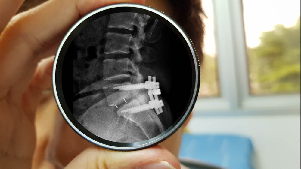 A doctor holds an enlarged X-Ray