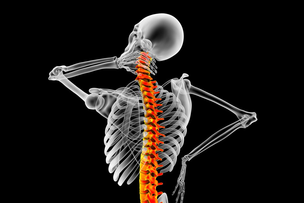 X-ray image of a skeleton holding its neck with a highlighted red spine on a black background, suggesting back pain or spinal issue.