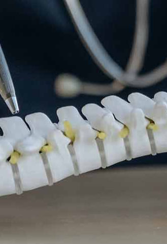 Get Endoscopic Spine Surgery in Phoenix | Desert Spine