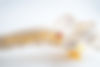lumbar-spine-displaced-herniated-disc-fragment-sp-2025-02-24-12-14-24-utc.jpg