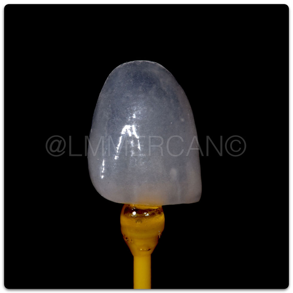 Laminate Veneers By L. Murat MERCAN