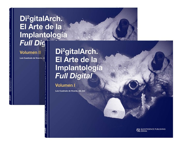Di2gital. El Arte de la Implantología Full Digital ( 2 VLS.)