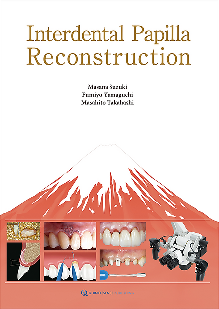 Interdental Papilla Reconstruction | Hartman Books