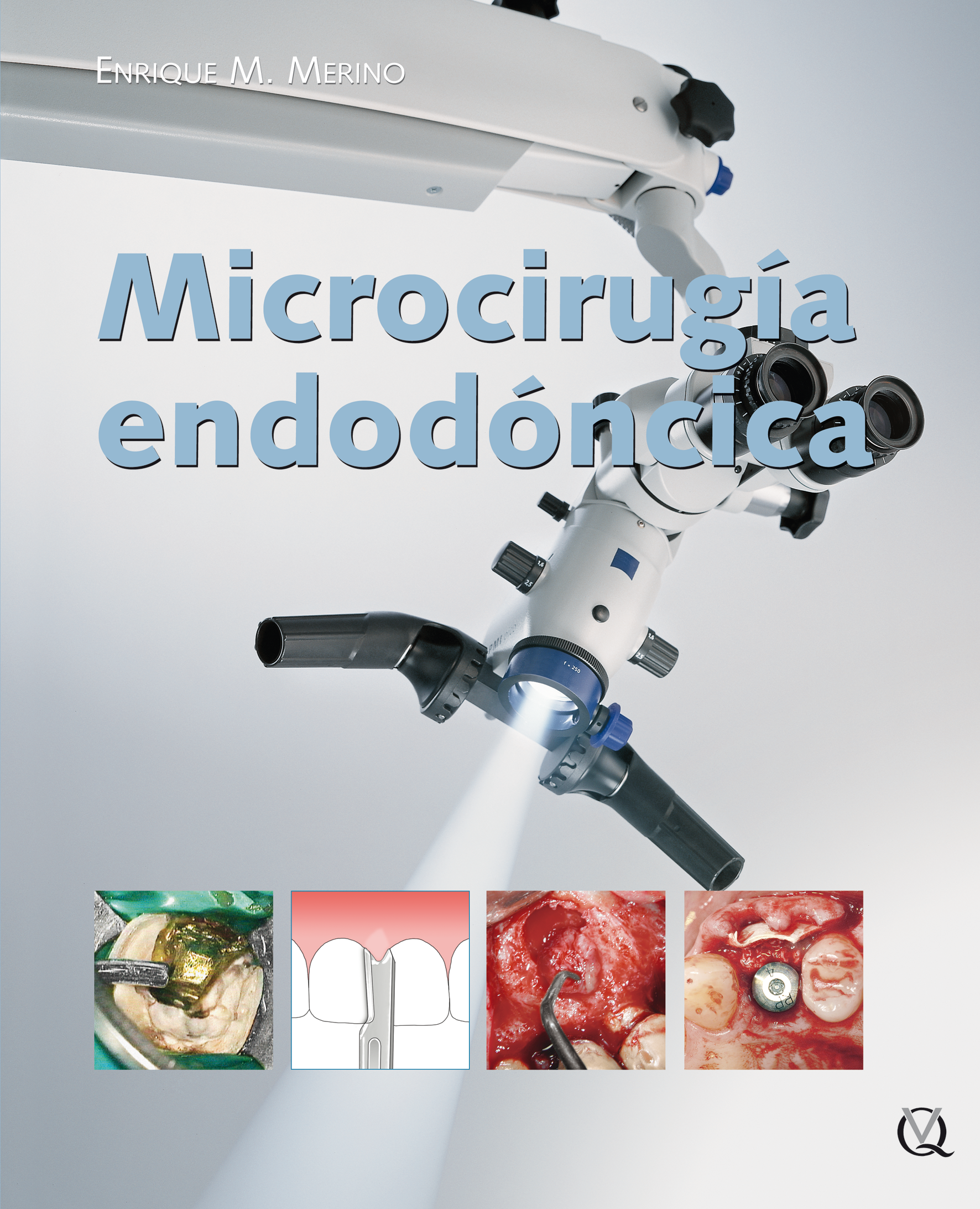 Microcirugía endodóncica