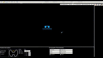 15 sec UT - DICOM Analysis on PC.gif