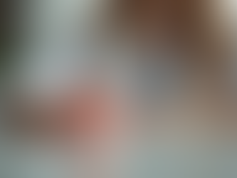 Neden Invisalign? Marmaris’te Şeffaf Plak Tedavisi Hakkında Bilmeniz Gereken Her Şey