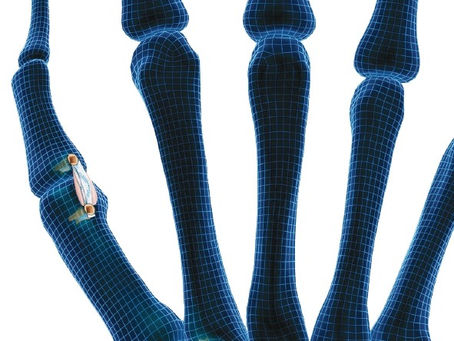 Transformando el Cuidado Médico: La Historia y Compromiso de Ortho-Cardio