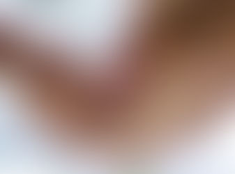 Thực phẩm bẩn là nguyên nhân hàng đầu dẫn đến ung thư