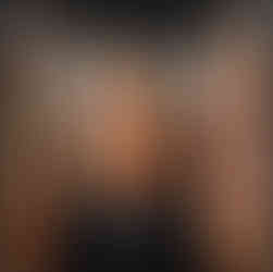 Melody