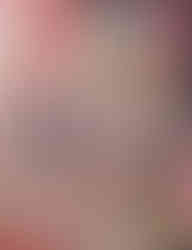 POX