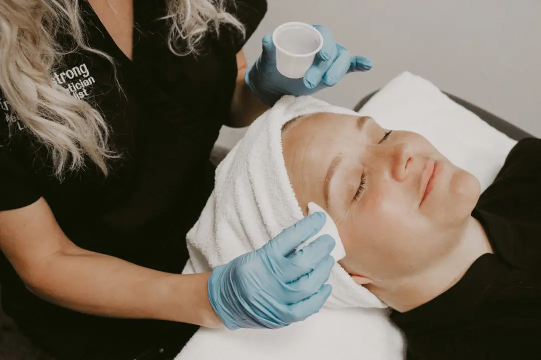 CHEMICAL PEEL