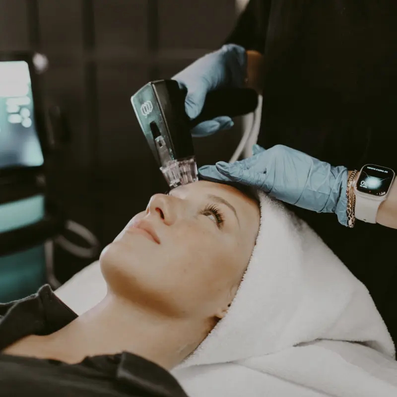 MICRONEEDLING + MORPHEUS8
