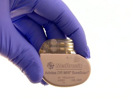 Pacemakers: A Small Device That Makes a Big Difference | How Pacemakers Work