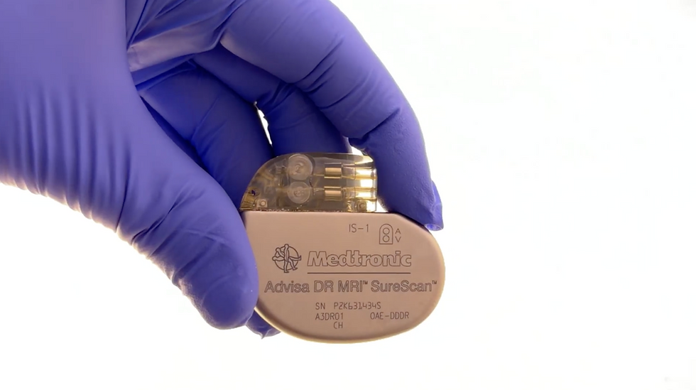 Pacemakers: A Small Device That Makes a Big Difference | How Pacemakers Work