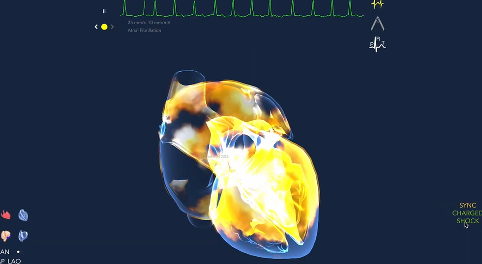 Repeated Cardioversions or Catheter Ablation: Which Is the Better Treatment for Atrial Fibrillation?