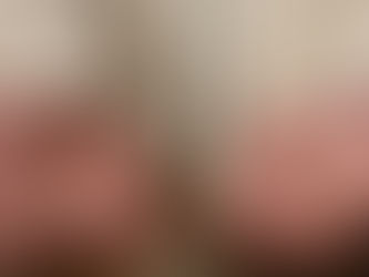 We Need to See the Scars