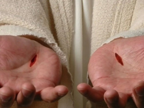 We Need to See the Scars