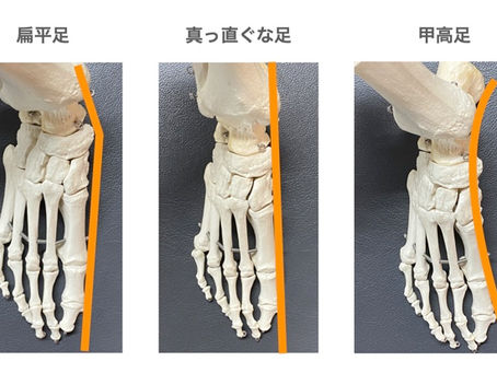 正しい姿勢③足部の修正と重心について|パーソナルトレーニング|吹田市千里山|ライフフィットジム