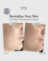 Glassifier + Exosome Skin Booster