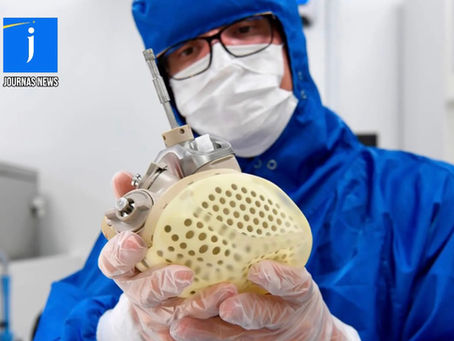 ФРАНЦЫН CARMAT КОМПАНИЙ ХӨГЖҮҮЛЖ БУЙ ХИЙМЭЛ ЗҮРХ “AESON”