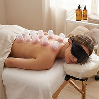 Cupping Therapy Back.jpg