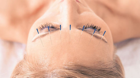 Acupuntura-estetica.jpeg