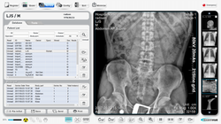 RS_DR flat panel detector_image 03
