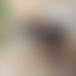 Reconstruction d’aréoles après mastectomie : à quoi s’attendre avant, pendant et après la dermopigmentation ?