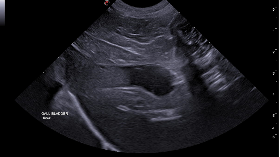Abdominal ultrasound: Sagittal view of the liver and gall bladder in a dog. Note the region of falciform fat in the near field which is slightly hypoechoic to the liver parenchyma. Cranial gall bladder content is also displaying slice thickness artefact.