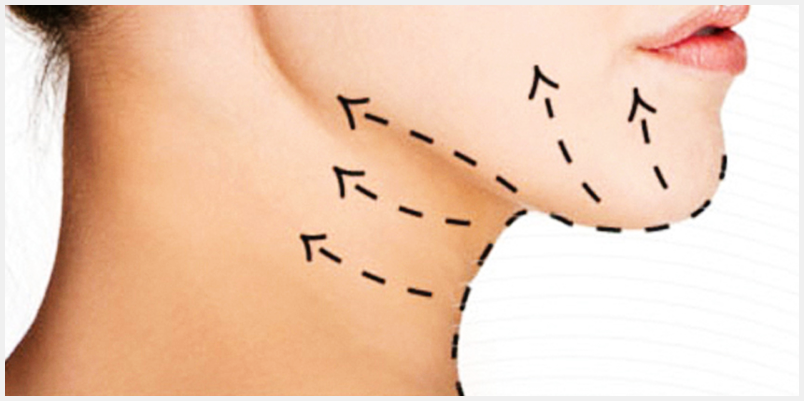 FIOS DE SUSTENTAÇÃO