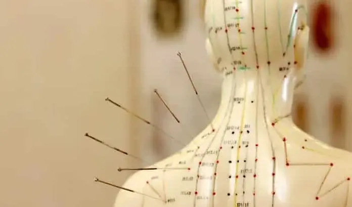 O que são pontos de acupuntura?