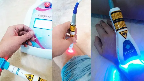 Laser e LED