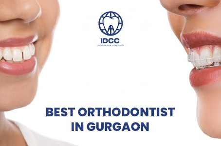 Best Orthodontist in Gurgaon for Teen Braces Treatments – IDCC Dental