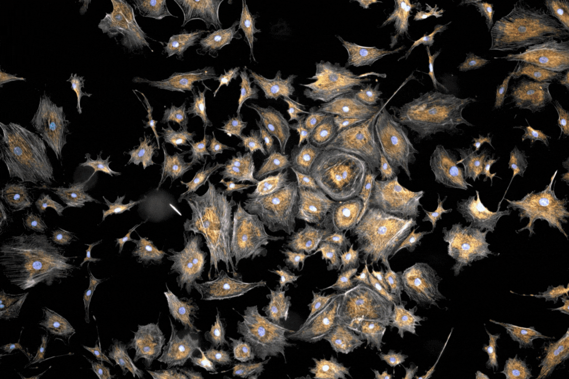 Efficient and intelligent analysis.gif