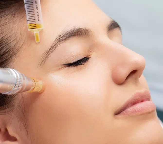 PRP-Facials.jpg.webp